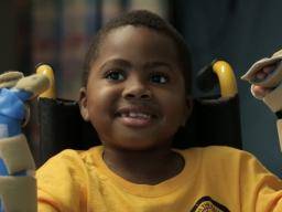 8letý chlapec se stává prvním dítetem, který obdrzí transplantaci s dvojitou rukou