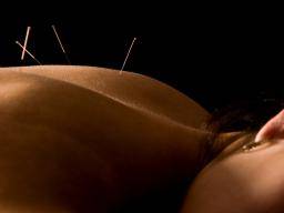 Akupunktura je úcinná pro zmírnení bolesti v období