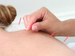 Akupunktur kann Schwere und Häufigkeit von Hitzewallungen in der Menopause reduzieren