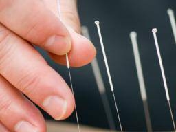 Akupunktur reduziert Hitzewallungen, Nachtschweiß in der Menopause
