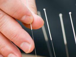 Akupunktur "sicher und effektiv" für chronische Schmerzen bei Kindern