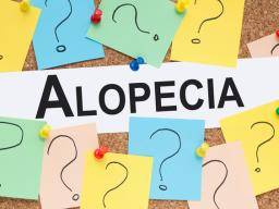 Alopezie: Haarwachstum mit neuer Droge wiederhergestellt