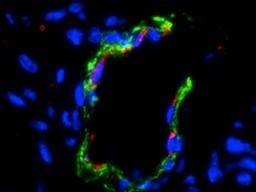 Amniotische Stammzellen steigern das Blutgefäßwachstum in der Hydrogel-Therapie