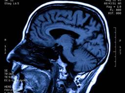 "Ancient brain" hilft uns, Kanten zu interpretieren
