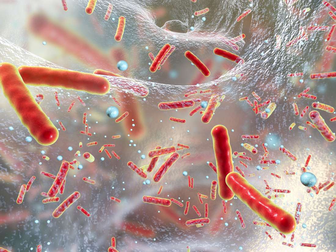 Antibiotikaresistenz: Wie ist es zu einer globalen Bedrohung für die öffentliche Gesundheit geworden?