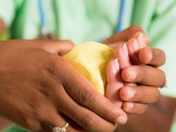 Arthritis mutilans: Was Sie wissen müssen