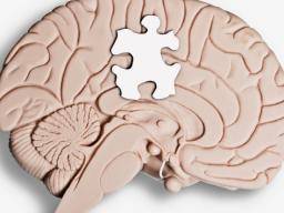 Autismus casteji u lidí, jejichz mozky jsou anatomicky více muzské