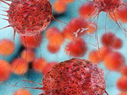 Biomarker-Entdeckung bietet "Hoffnungsschimmer" für Frauen mit aggressivem Brustkrebs