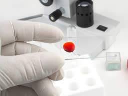 Biotrons Hepatitis C-Medikament zeigt Versprechen in Phase 2A-Studie