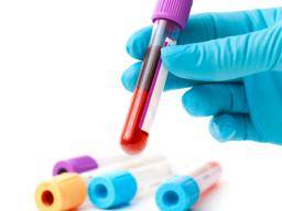 Krevní test by mohl zjistit, kterí pacienti potrebují antibiotika