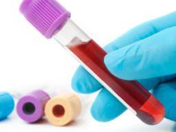 Krevní test na prognózu rizika koronární srdecní choroby schválený FDA