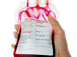 Bloedtransfusies worden veel gebruikt tijdens hartchirurgie