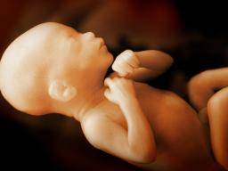 Gehirnveränderungen bei Frühgeborenen können Wochen vor der Geburt beginnen