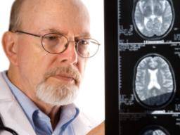 Das Gehirn kann frühe Alzheimer-Schäden "umgehen"