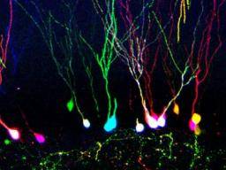 Výzkum v oblasti mozku vyuzívá nové techniky oznacování bunek