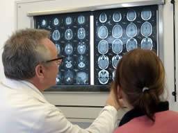 Stimulátor mozku snizuje záchvaty u pacientu s epilepsií rezistentní na léky