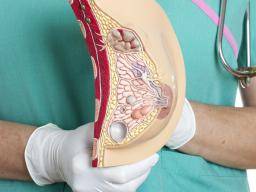 Cáncer de mama: deficiencia bacteriana vinculada con el inicio