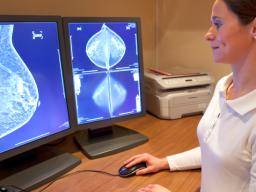 Brustkrebs: Veränderungen der Immunzellzusammensetzung in Verbindung mit zukünftigen Risiken