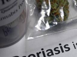 ¿El cannabis puede ayudar a tratar la psoriasis?