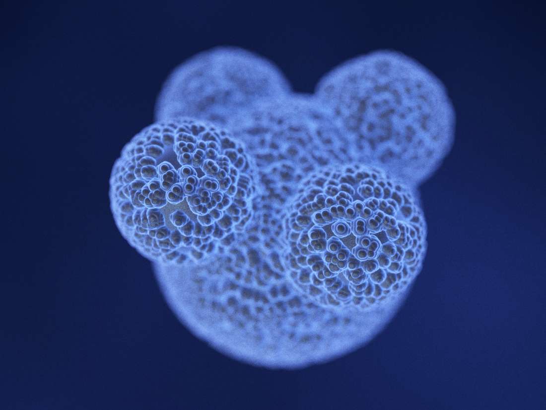 Cellules souches cancéreuses détruites par des nanoparticules remplies de médicaments
