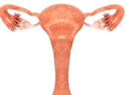 La découverte de cellules met en lumière les troubles ovariens