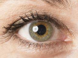 Centrine heterochromija (dvi skirtingos akiu spalvos): priezastys ir tipai