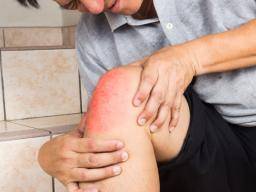 Häufige Ursachen für schwere Knieschmerzen