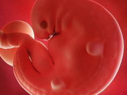 Antikoncepcní implantáty spojené s opakovanými potraty