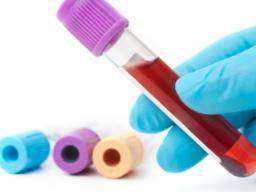 Mohl by být na obzoru "univerzální" krevní test na rakovinu?