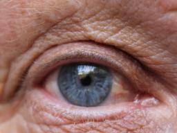 Könnte die Augenfarbe das Risiko einer Alkoholabhängigkeit vorhersagen?