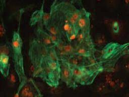 Lécba mitochondriálních onemocnení se blízí prulomu kmenových bunek