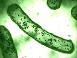 Haben Bakterien eingebaute Zelltodmechanismen?