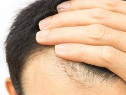 ¿Funciona la biotina para el crecimiento del cabello?