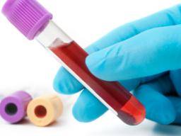 Das Blut von Ebola-Überlebenden wird als Behandlungsoption evaluiert