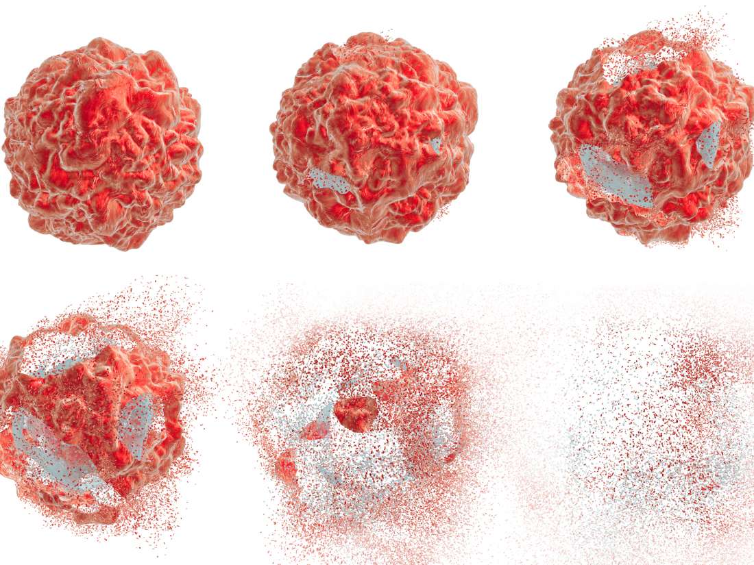 Cáncer de endometrio: las nanopartículas cargadas de fármacos destruyen las células tumorales