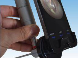 Endoscope-i: ein Spielwechsler im Taschenformat