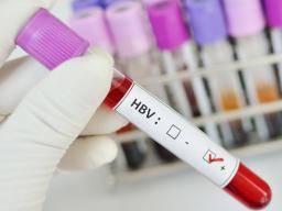 Alles was Sie über Hepatitis B wissen müssen