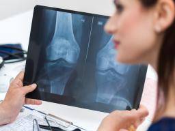 Tout ce qu'il faut savoir sur l'ostéopénie: causes, traitements et prévention