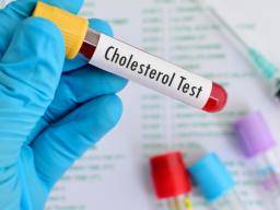 Uz pred hladem cholesterolu není potreba, tvrdí odborníci