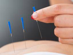 Les personnes souffrant de fibromyalgie pourraient bénéficier d'une acupuncture adaptée