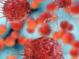 Vier neue Gene wurden zur "ererbten Brustkrebs" -Risikoliste hinzugefügt