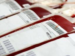 Cerstvá celá krev pro pediatrickou srdecní chirurgii "muze snízit riziko onemocnení souvisejících s transfuzí"
