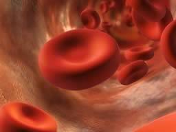 Gen mit einer Entzündung in der Aorta assoziiert könnte zu Bauchaortenaneurysma führen