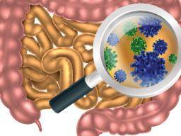 Bakterie streva zprostredkovávají spojení mezi stravou a kolorektálním karcinomem