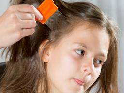 Kopfläuse: Forscher identifizieren weit verbreitete Resistenz gegen übliche Behandlungen