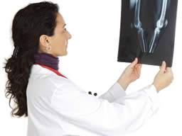 Hüfte-Implantat-Ausfall wahrscheinlicher in den Frauen