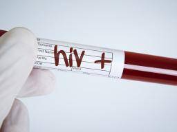 Prulom v oblasti HIV: Vedci odstranují virus u zvírat pomocí úpravy genu