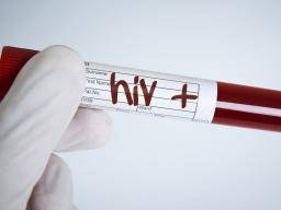 HIV: Könnte neue Injektion genauso wirksam sein wie tägliche Medikamente?