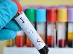 Nástroj na "otisky prstu" HIV by mohl znacne napomoci vývoji vakcíny