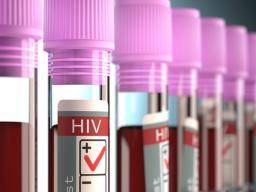 HIV: Nove objevená soucást by mohla vést k úcinnejsím lékum